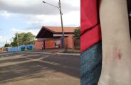 Educa&ccedil;&atilde;o 'investiga' caso de agress&atilde;o contra aluno autista na rede municipal