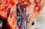 Pol&iacute;cia Civil de MS apreende 600 kg de carne clandestina em a&ccedil;ougue