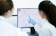 Como funciona o novo medicamento para pacientes com linfoma n&atilde;o Hodgkin agressivo
