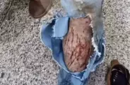Trabalhador &eacute; atacado por animal durante servi&ccedil;o em Ponta Por&atilde;