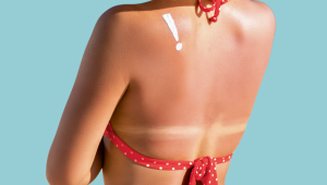 Sa&uacute;de B+: Voc&ecirc; sabia que bronzeado saud&aacute;vel n&atilde;o existe? Confira!