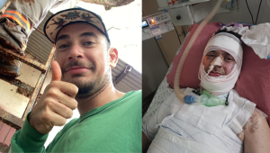 Paciente que teve o corpo queimado aguarda há cinco meses por exame