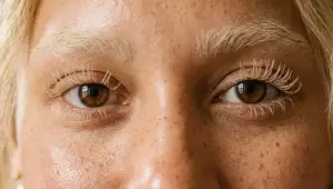 Voc&ecirc; sabia que descolorir c&iacute;lios pode perfurar os olhos?