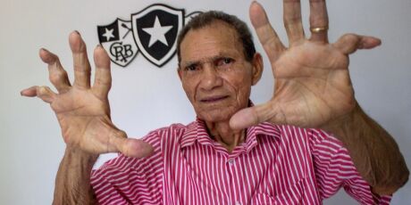 Ex-Operário, lendário goleiro Manga morre aos 87 anos