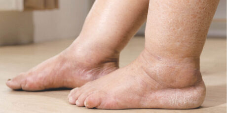 Pesquisa aponta que 12,3% da população feminina do Brasil pode ter doença "invisível"