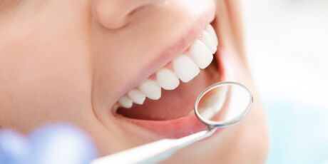 Saúde B+: Periodontite: doença bucal que afeta milhões de brasileiros e quase ninguém percebe