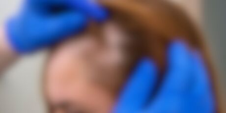 Empresa de cosméticos terá que indenizar consumidora que sofreu queimaduras