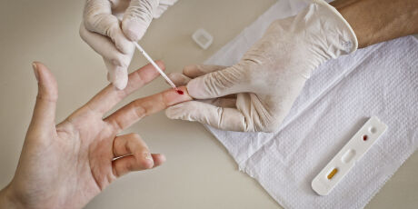 Mortes por aids caem 4% no per&iacute;odo de um ano em MS