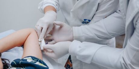 MS entra na lista de prioridade para receber Implanon pelo SUS