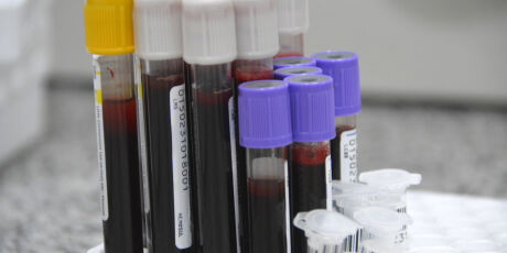 Hemosul d&aacute; novas exig&ecirc;ncias para doadores que usam canetas emagrecedoras