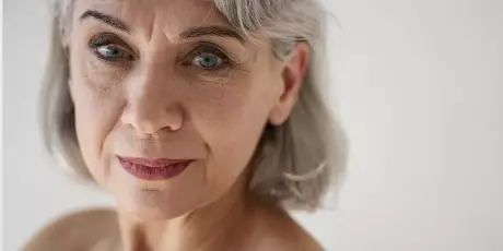 Rugas: saiba como lidar com elas e tamb&eacute;m fazer e a preven&ccedil;&atilde;o