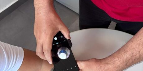 Telediagn&oacute;stico j&aacute; identificou 357 casos de c&acirc;ncer de pele em MS