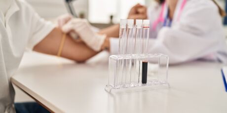 Testes gen&eacute;ticos ajudam a identificar predisposi&ccedil;&otilde;es e poss&iacute;veis tratamentos para o c&acirc;ncer