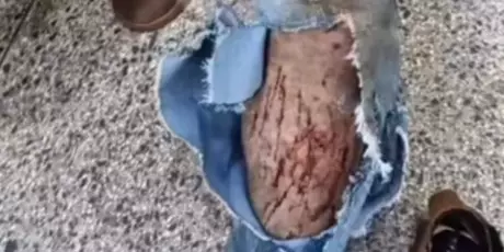 Trabalhador &eacute; atacado por animal durante servi&ccedil;o em Ponta Por&atilde;