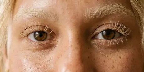 Voc&ecirc; sabia que descolorir c&iacute;lios pode perfurar os olhos?