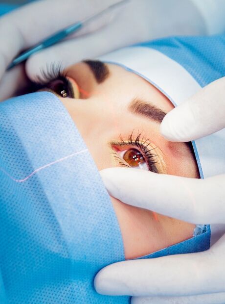 Saúde B+: Ceratocone aumenta risco de catarata em jovens. Entenda.