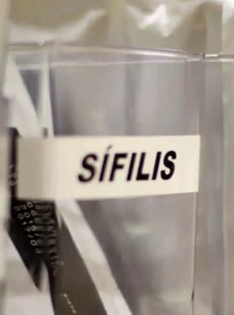 S&iacute;filis continua em ritmo acelerado de crescimento no pa&iacute;s