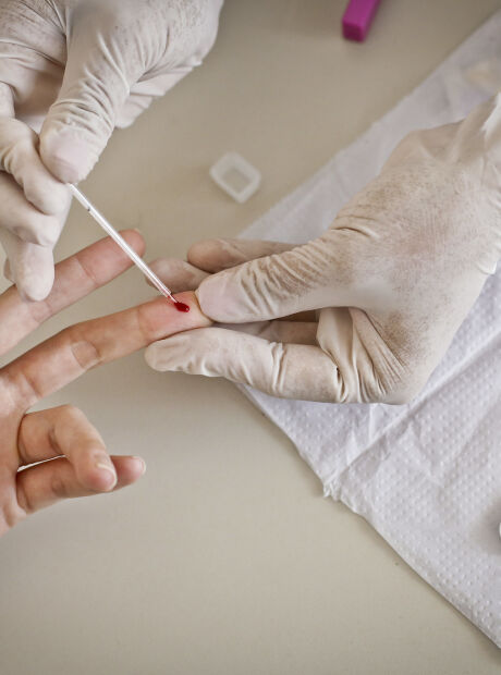 Mortes por aids caem 4% no período de um ano em MS