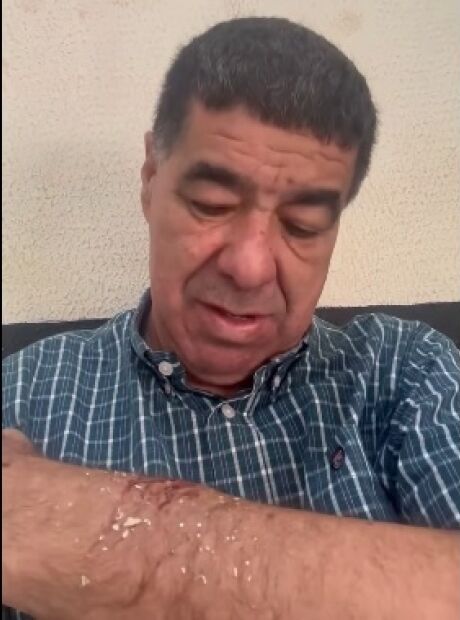 Subprefeito se envolve em briga com faca e garrafa t&eacute;rmica e vai parar na delegacia