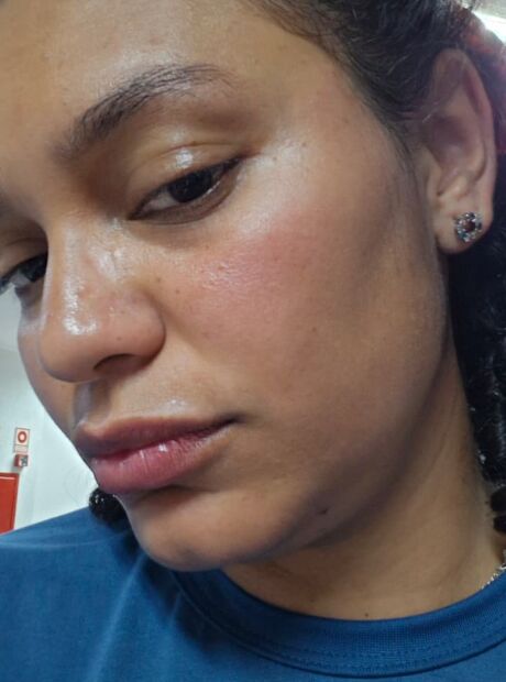 Professora &eacute; agredida durante manifesta&ccedil;&atilde;o em Campo Grande