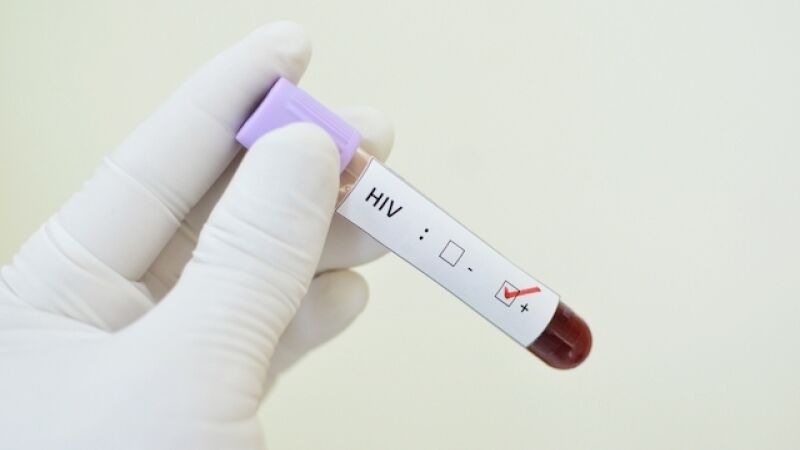 Testes de HIV