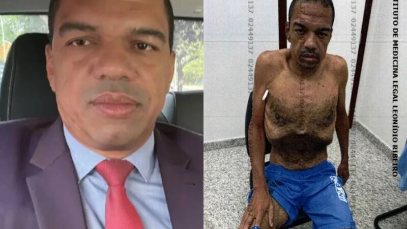 Andreson de Oliveira Gonçalves emagreceu na prisão