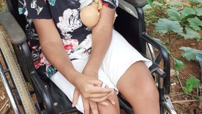 Jussara Marisa tinha paralisia cerebral e morreu aos 49 anos