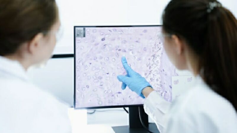 Pesquisadoras analisam amostras em laboratório durante estudos sobre o linfoma não Hodgkin, tipo de câncer que ganhou uma nova opção de tratamento aprovada pela Anvisa.