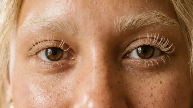 Você sabia que descolorir cílios pode perfurar os olhos?