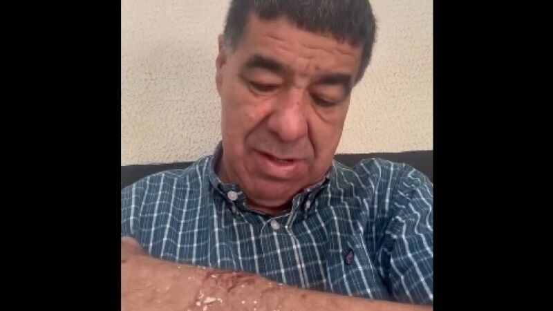 Subprefeito diz ter sido atingido por garrafa na região do punho