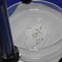 MS confirma 17&ordf; morte por chikungunya e iguala total de 2025