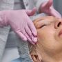 Saiba por que aumentou a procura pelo procedimento de lifting facial