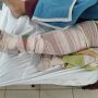 Assaltantes armados atropelam mulher para roubar motocicleta na Capital