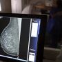 Plano de sa&uacute;de ter&aacute; que cobrir mamografia digital para todas as idades