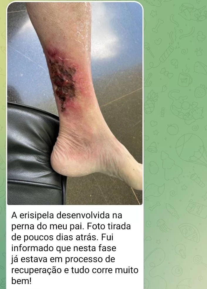 Carlos Bolsonaro postou ferimento na perna de Bolsonaro